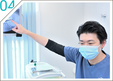 04 粘膜まで見る口腔内管理